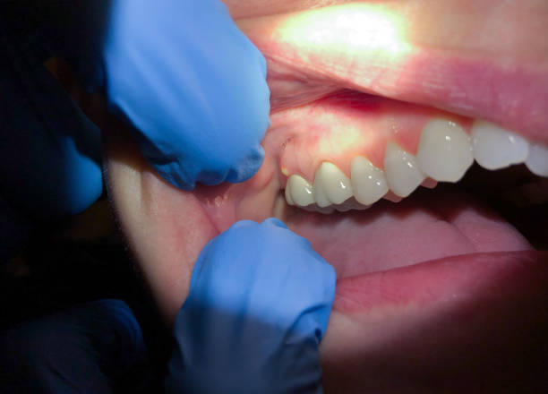 Best 24-Hour Emergency Dentist in Lakes East, CT